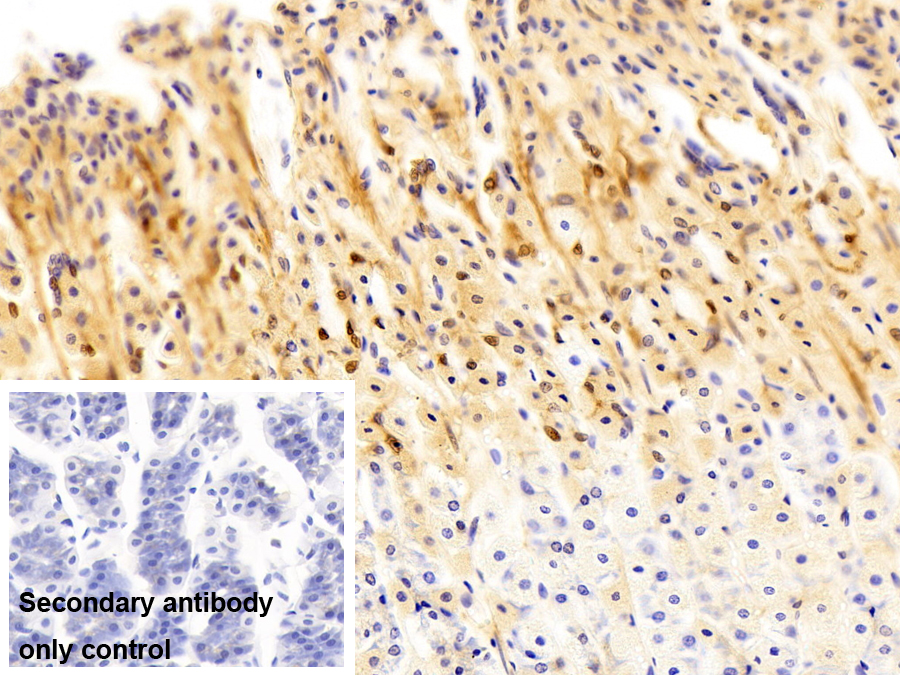 Polyclonal Antibody to S100 Calcium Binding Protein A6 (S100A6)