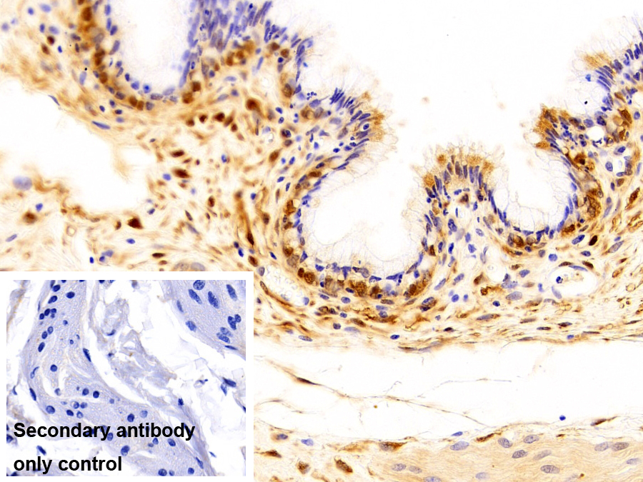 Polyclonal Antibody to S100 Calcium Binding Protein A6 (S100A6)