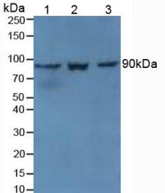 Polyclonal Antibody to Transglutaminase 1 (TGM1)