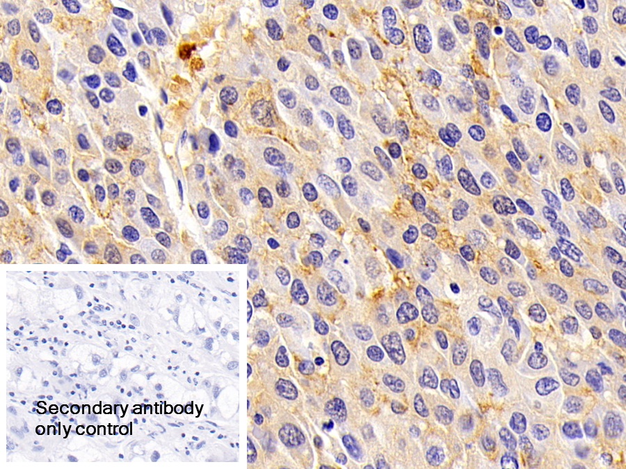 Polyclonal Antibody to Orosomucoid 2 (ORM2)