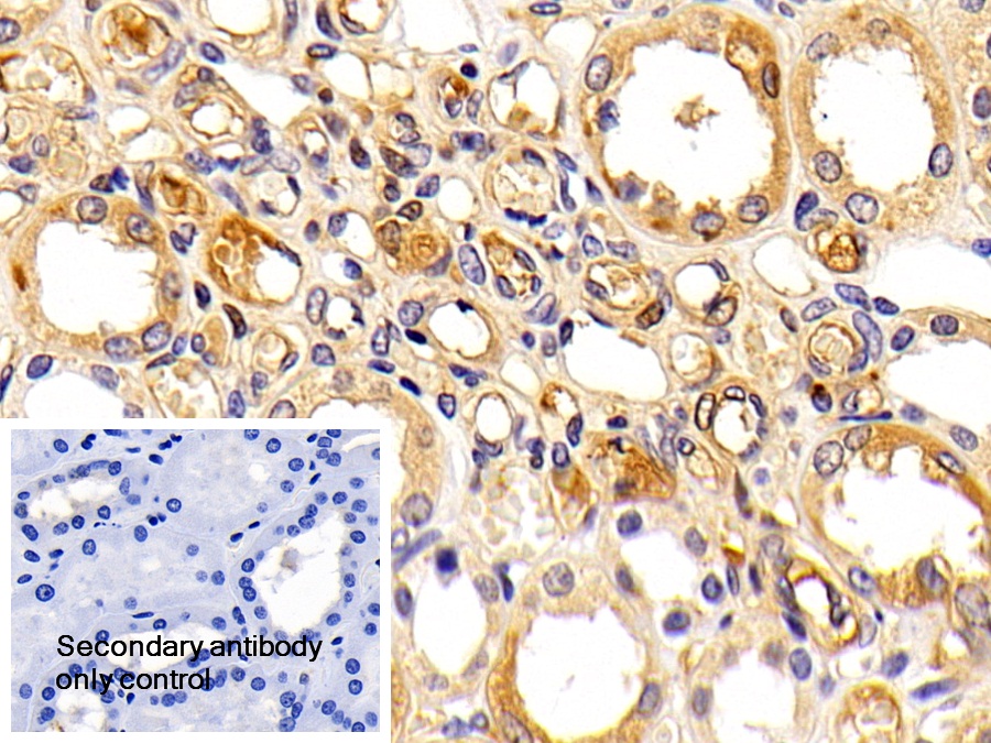 Polyclonal Antibody to Orosomucoid 2 (ORM2)