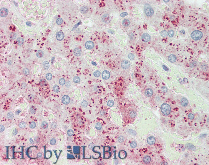 Polyclonal Antibody to Orosomucoid 2 (ORM2)