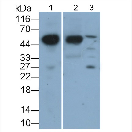 Polyclonal Antibody to Orosomucoid 2 (ORM2)