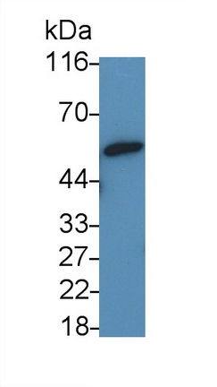 Polyclonal Antibody to Orosomucoid 2 (ORM2)