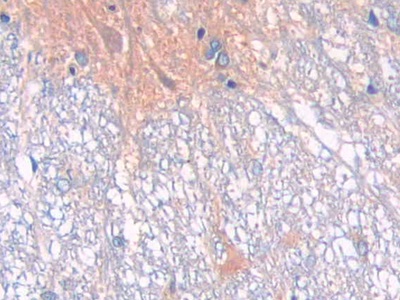 Polyclonal Antibody to Neprilysin (CD10)