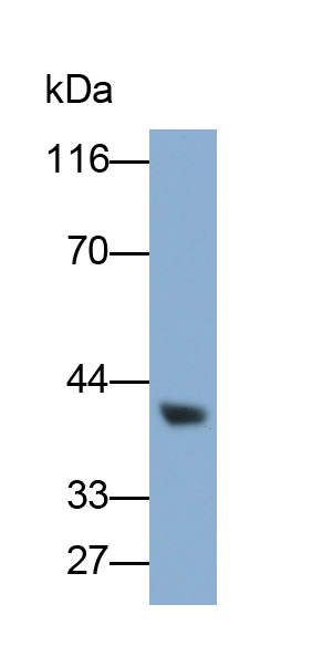 Polyclonal Antibody to Receptor Interacting Serine Threonine Kinase 2 (RIPK2)