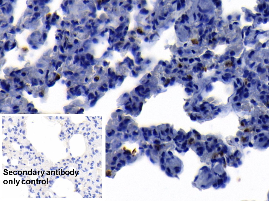 Polyclonal Antibody to S100 Calcium Binding Protein A8 (S100A8)