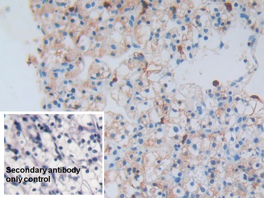 Polyclonal Antibody to S100 Calcium Binding Protein A8 (S100A8)