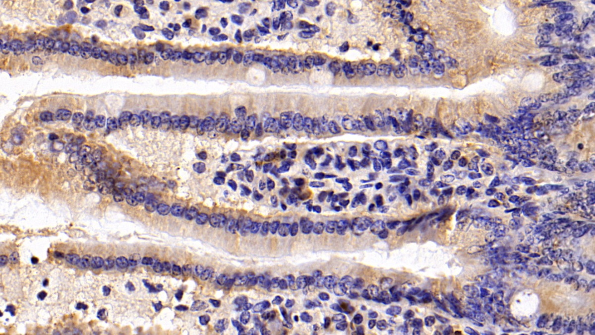 Polyclonal Antibody to S100 Calcium Binding Protein A8 (S100A8)