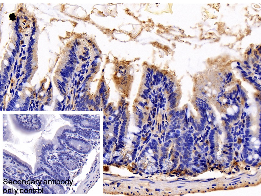 Polyclonal Antibody to S100 Calcium Binding Protein A8 (S100A8)