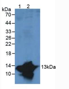 Polyclonal Antibody to S100 Calcium Binding Protein A9 (S100A9)