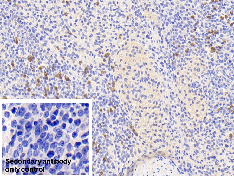 Polyclonal Antibody to S100 Calcium Binding Protein A9 (S100A9)