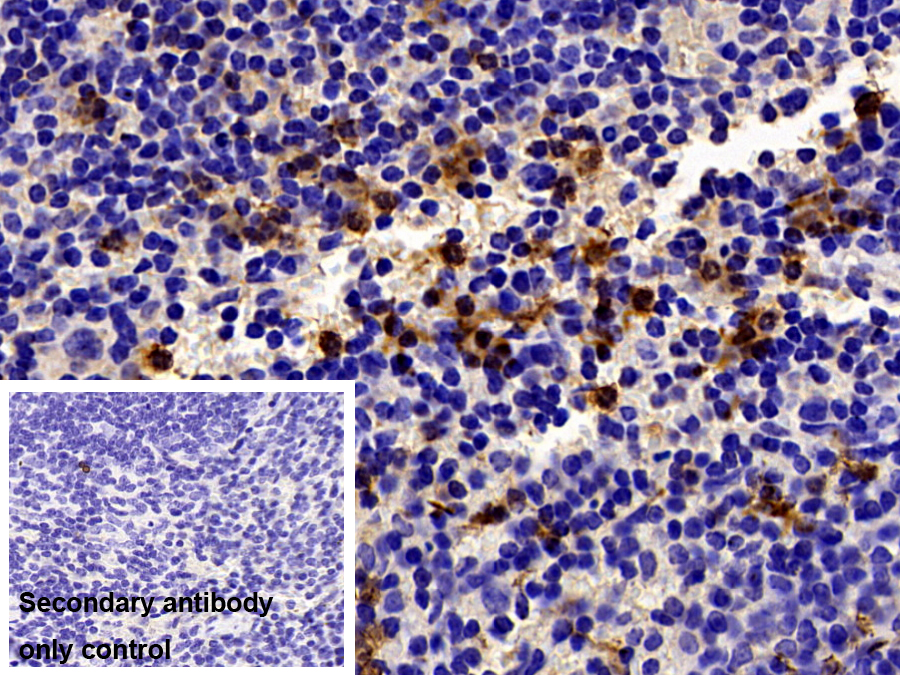 Polyclonal Antibody to S100 Calcium Binding Protein A9 (S100A9)