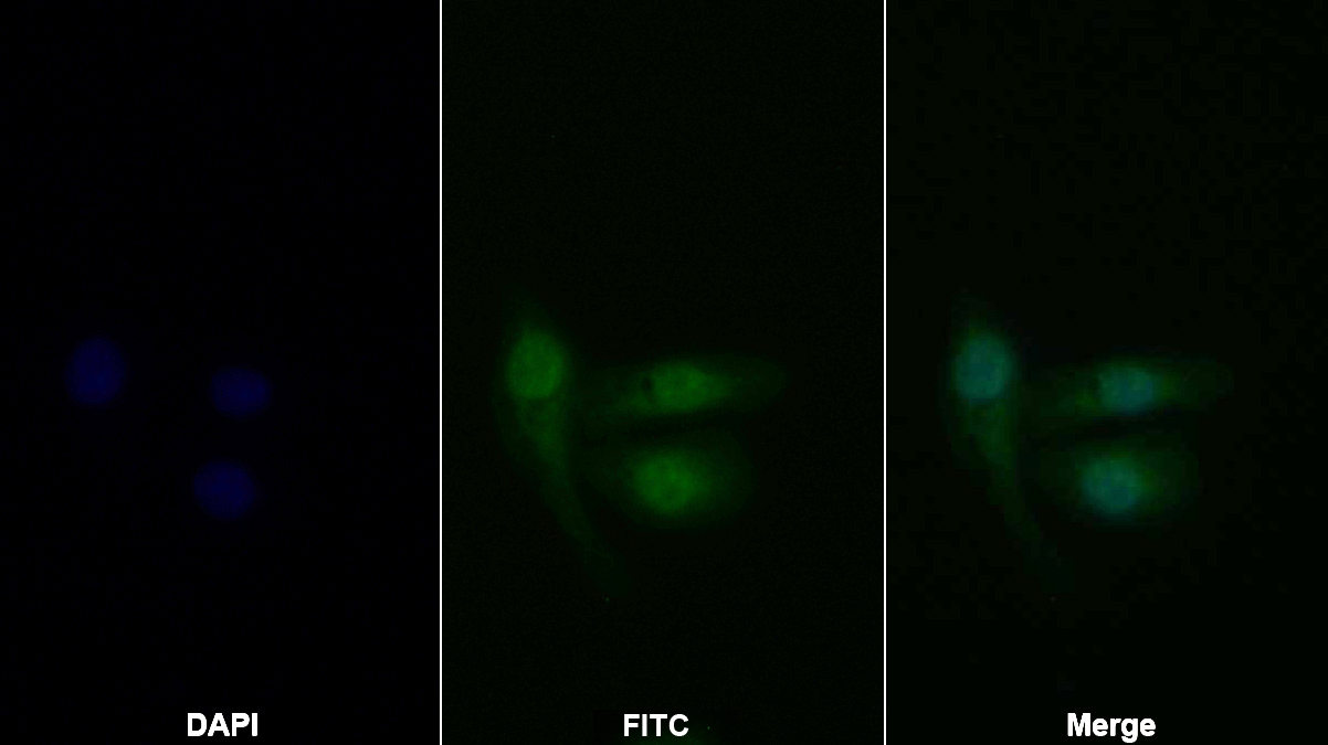 Polyclonal Antibody to Signal Transducer And Activator Of Transcription 2 (STAT2)