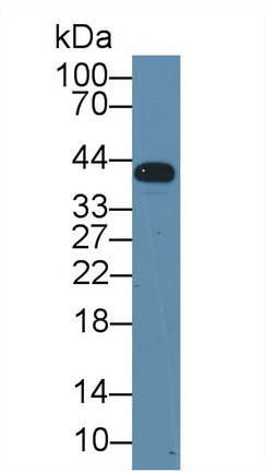 Polyclonal Antibody to Natural Cytotoxicity Triggering Receptor 1 (NCR1)