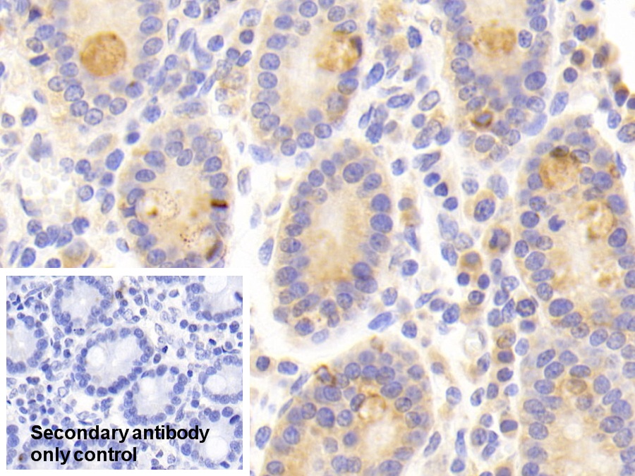 Polyclonal Antibody to High Molecular Weight Kininogen (HMWK)