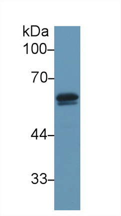 Polyclonal Antibody to Vitamin D Binding Protein (DBP)