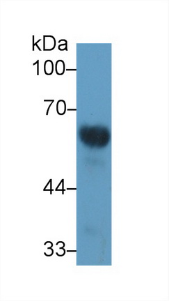 Polyclonal Antibody to Vitamin D Binding Protein (DBP)