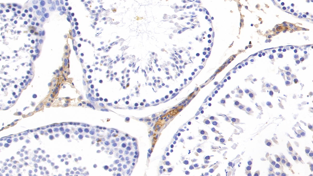 Polyclonal Antibody to Vitamin D Binding Protein (DBP)