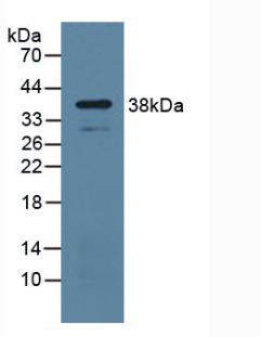 Polyclonal Antibody to Uridine Phosphorylase 1 (UPP1)