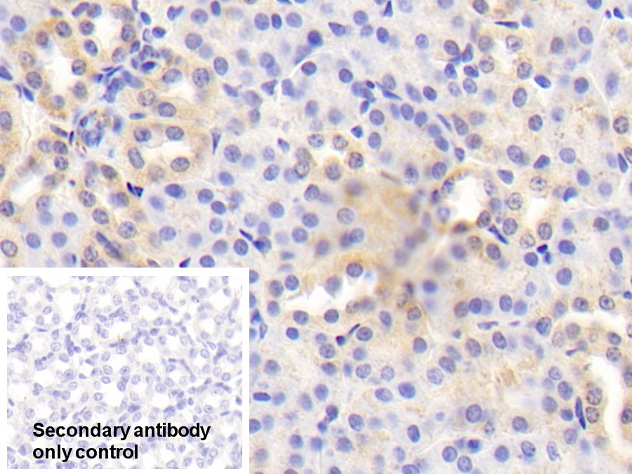 Polyclonal Antibody to Beta Secretase 2 (BACE2)