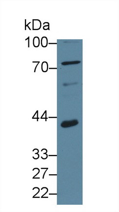 Polyclonal Antibody to Squamous Cell Carcinoma Antigen 1/2 (SCCA1/SCCA2)