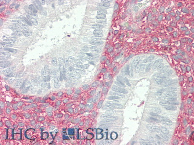 Polyclonal Antibody to Versican (VCAN)