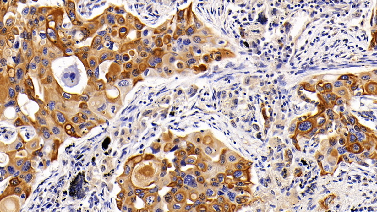 Polyclonal Antibody to Cytokeratin 17 (CK17)