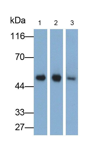 Polyclonal Antibody to Cytokeratin 17 (CK17)