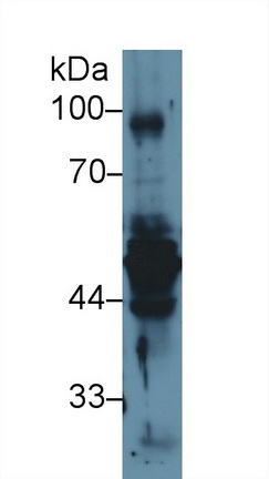 Polyclonal Antibody to Cytokeratin 17 (CK17)