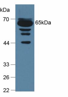 Polyclonal Antibody to Complement Component 9 (C9)