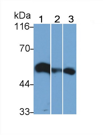 Polyclonal Antibody to Nuclear Factor Kappa B (NFkB)