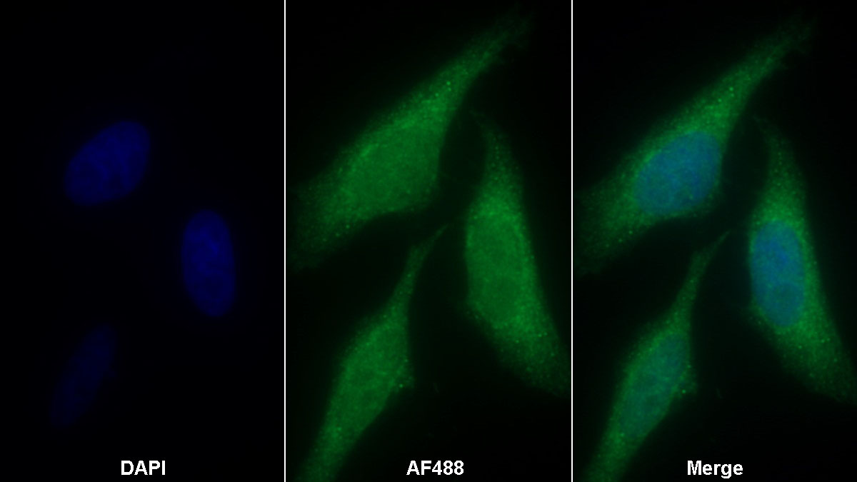 Polyclonal Antibody to Nuclear Factor Kappa B (NFkB)