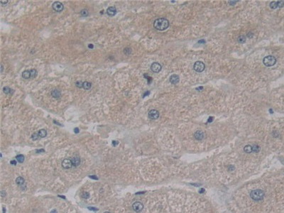 Polyclonal Antibody to Nuclear Factor Kappa B (NFkB)