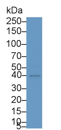 Polyclonal Antibody to Nuclear Factor Kappa B (NFkB)