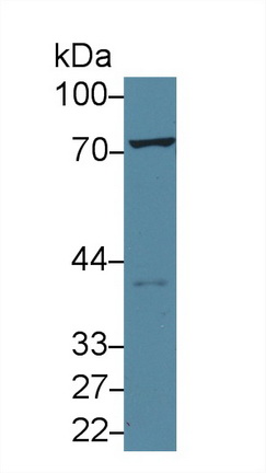 Polyclonal Antibody to Transglutaminase 2 (TGM2)