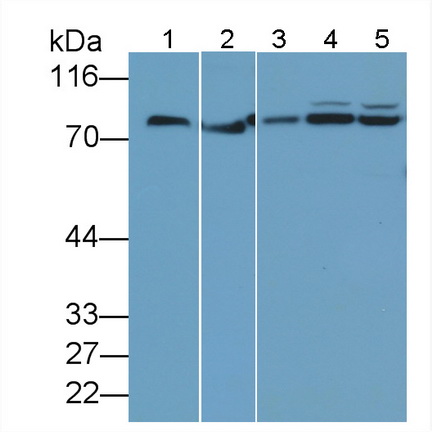 Polyclonal Antibody to Transglutaminase 2 (TGM2)