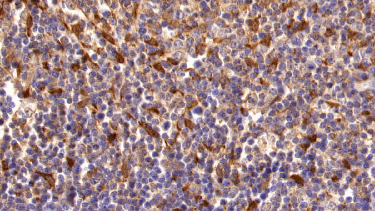 Polyclonal Antibody to Transglutaminase 2 (TGM2)