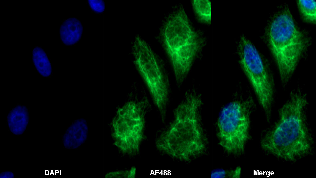 Polyclonal Antibody to Interleukin 2 Receptor Alpha (IL2Ra)