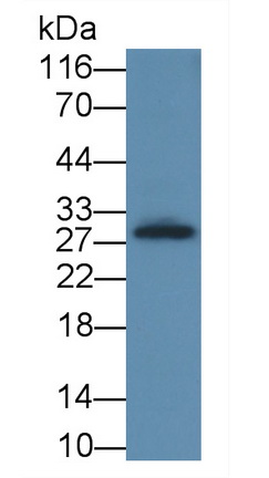 Polyclonal Antibody to Interleukin 2 Receptor Alpha (IL2Ra)