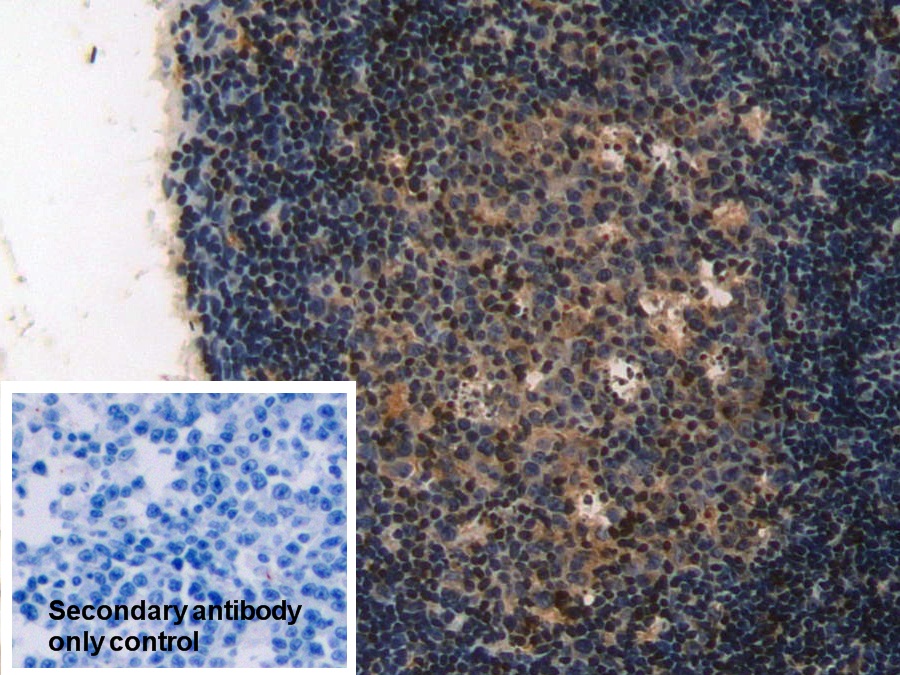 Polyclonal Antibody to Interleukin 2 Receptor Alpha (IL2Ra)