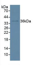 Polyclonal Antibody to Inhibitory Subunit Of NF Kappa B Alpha (IkBa)