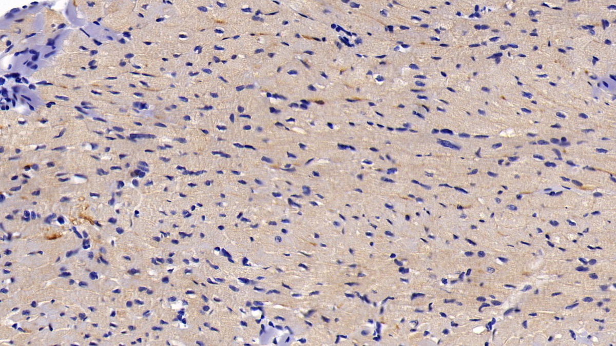 Polyclonal Antibody to Inhibitory Subunit Of NF Kappa B Alpha (IkBa)