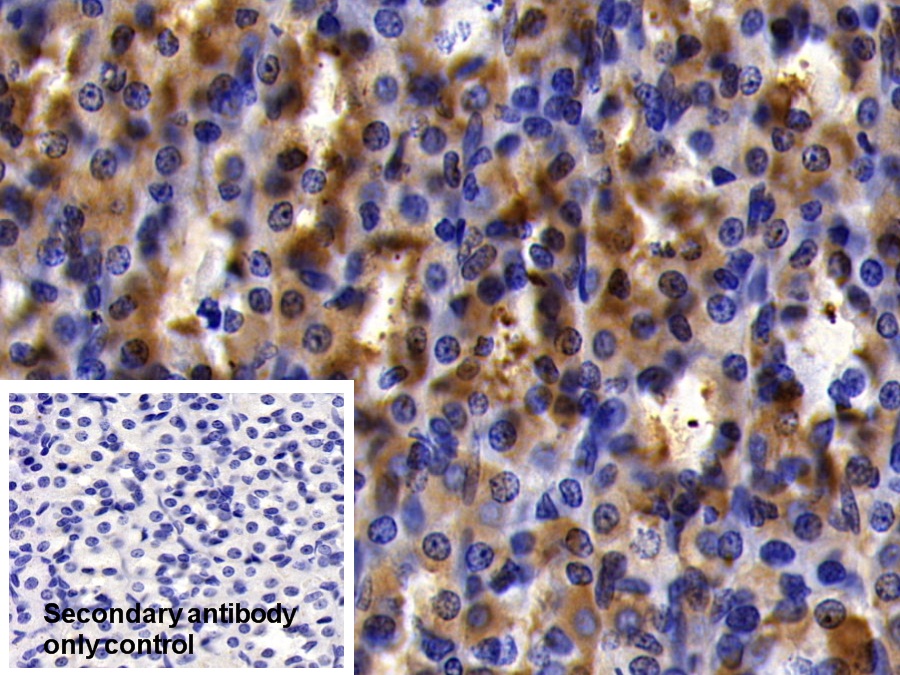 Polyclonal Antibody to Inhibitory Subunit Of NF Kappa B Alpha (IkBa)