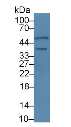 Polyclonal Antibody to Calumenin (CALU)