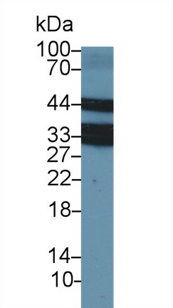 Polyclonal Antibody to Lectin Like Oxidized Low Density Lipoprotein Receptor 1 (LOX1)