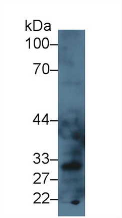 Polyclonal Antibody to Lectin Like Oxidized Low Density Lipoprotein Receptor 1 (LOX1)