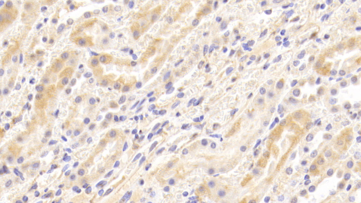 Polyclonal Antibody to Lectin Like Oxidized Low Density Lipoprotein Receptor 1 (LOX1)