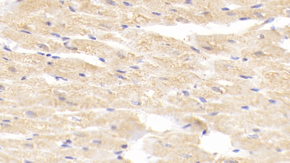 Polyclonal Antibody to Lectin Like Oxidized Low Density Lipoprotein Receptor 1 (LOX1)