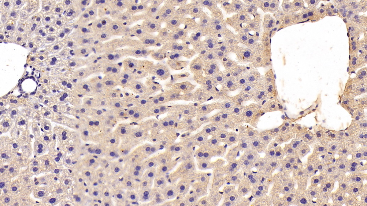 Polyclonal Antibody to Metallothionein 2 (MT2)